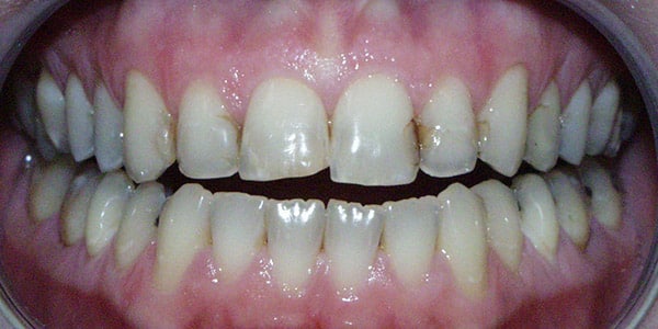 clair-before